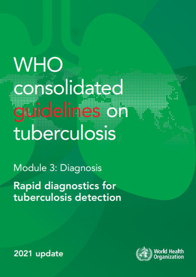 WHO  consolidated  guidelines on tuberculosis